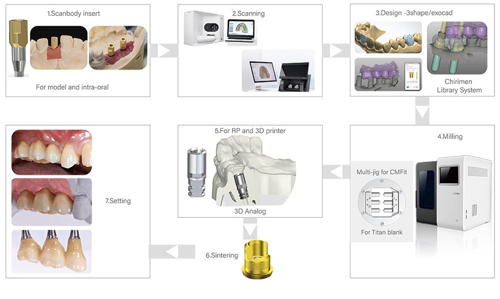 Dental CADCAM System Workflow